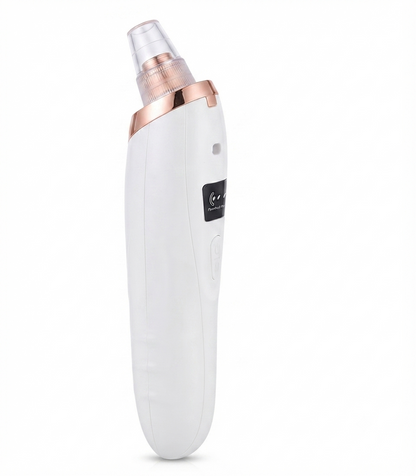 EXTRACTOR DE PUNTOS NEGROS