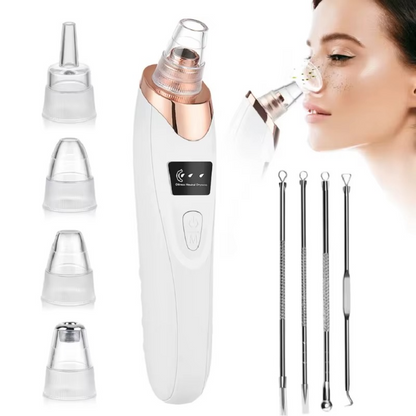 EXTRACTOR DE PUNTOS NEGROS